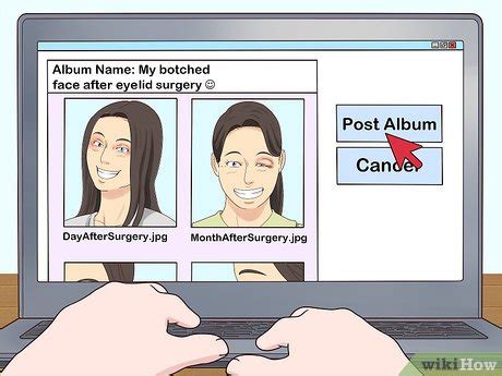 How to Get Cast for the TV Show Botched (with Pictures) - wikiHow