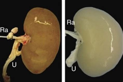 Lab Grown Kidney Transplanted Into Rat