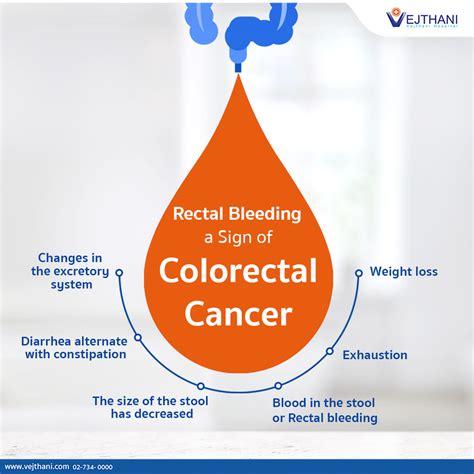 Colon Cancer Stool Color Chart