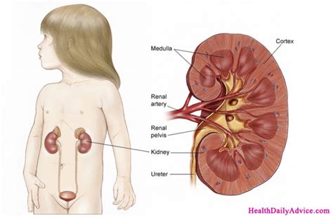 Wilms tumor - causes, symptoms, diagnosis, treatment & pathology - Health Daily Advice