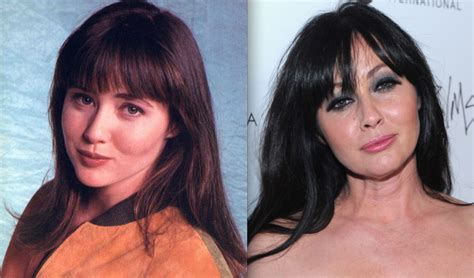 Shannen Doherty Plastic Surgery