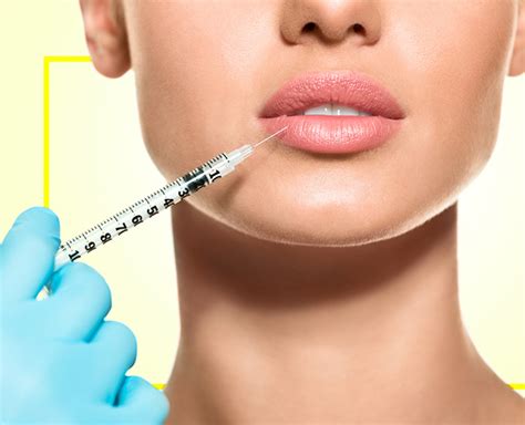 Planning For Lip Fillers? These 7 Points You Should Keep In Mind ...