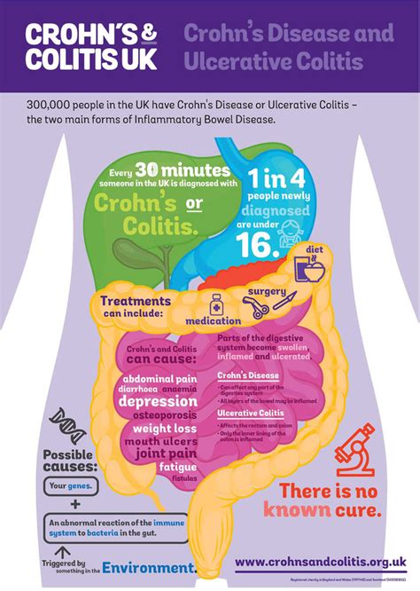 Inflammatory Bowel Disease: Crohn's & Ulcerative Colitis