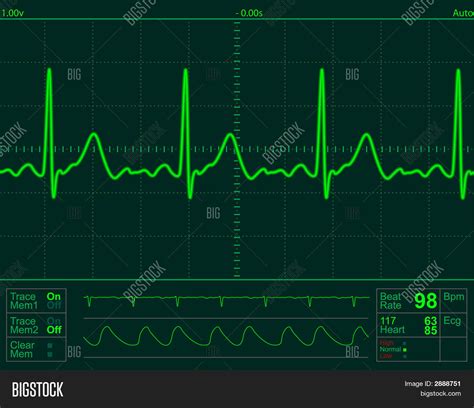 Heart Monitor Screen Image & Photo (Free Trial) | Bigstock