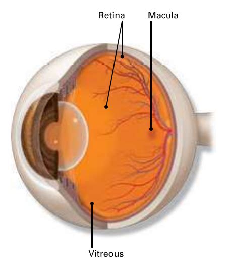 Vitreomacular Traction - Macula Retina Vitreous Center