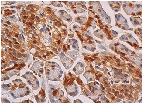 Anti-GAPDH Antibody (0411) | SCBT - Santa Cruz Biotechnology