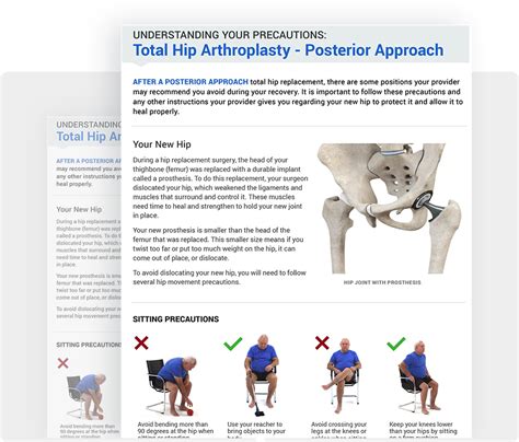 Printable Posterior Hip Precautions