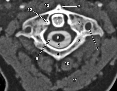 Cervical Spine Anatomy Radiology Key 34776 | Hot Sex Picture