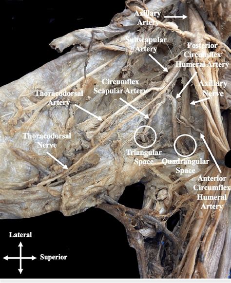 Anterior view of the left axilla region An anterior view of the left... | Download Scientific ...