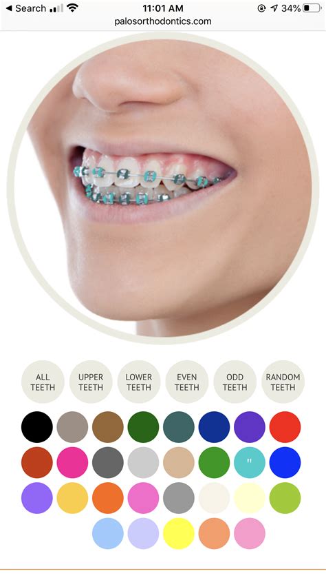 √ Color Palette For Braces