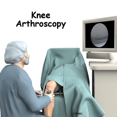 Knee Arthroscopy | eOrthopod.com