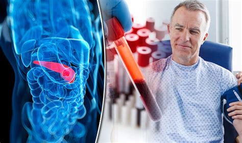 Pancreatic cancer symptoms - blood test could detect deadly cancer | Express.co.uk