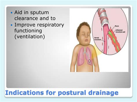 PPT - Mobilisation of secretions in infants and children PowerPoint ...