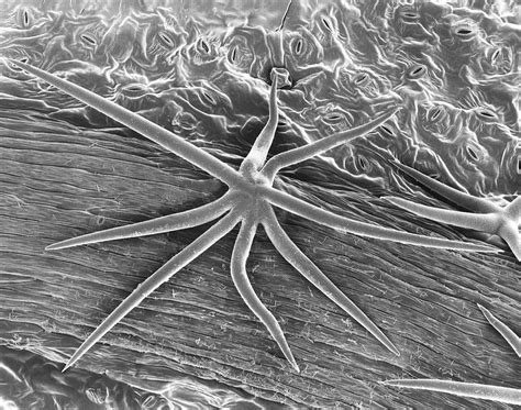 Plant Leaf Trichome (hibiscus Sp.) Photograph by Dennis Kunkel ...