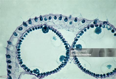 Volvox Flagellated Cells Daughter Colonies Thin Section 250x At 35mm Each Cell Has Two Flagellae ...