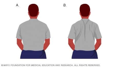 Slide show: Back exercises in 15 minutes a day - Mayo Clinic