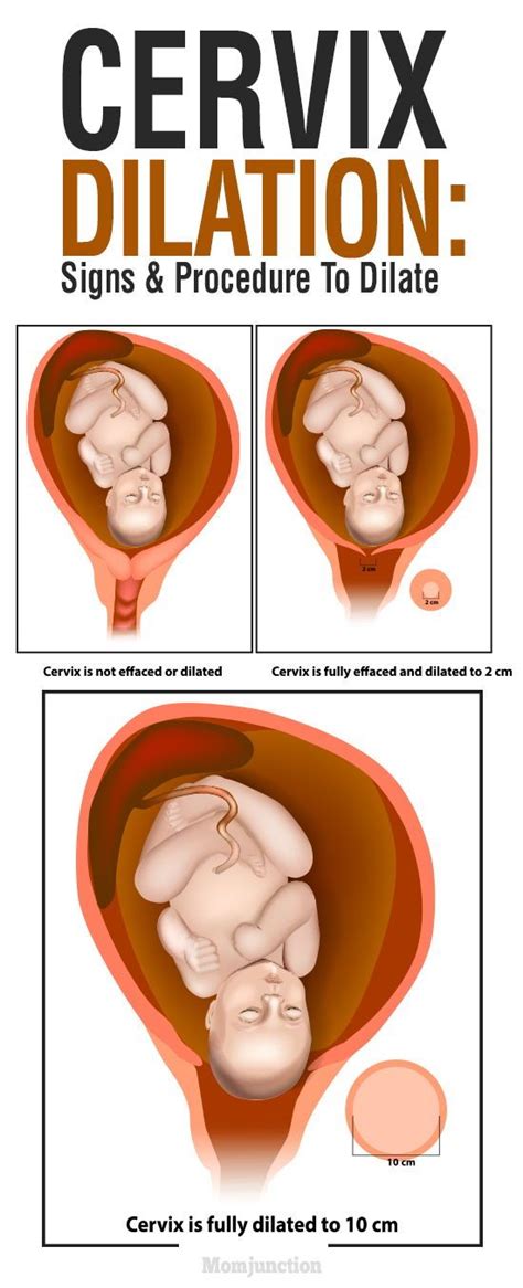 Cervix Dilation Chart: Signs, Stages And Procedure To Check | Sage femme