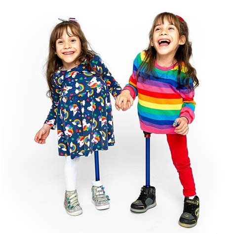 Formerly conjoined twin girls are flourishing | Stanford Medicine