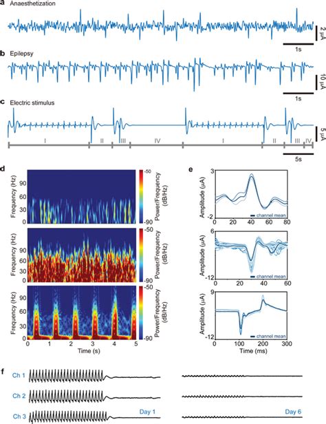 Characterization of μ‐ECoG signals for three representative stimuli.... | Download Scientific ...