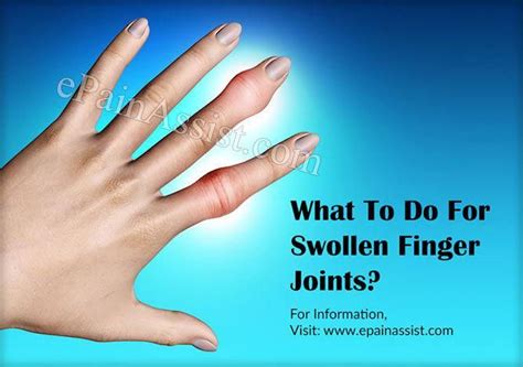 Swollen knuckle finger: 15 Causes of Swollen Fingers