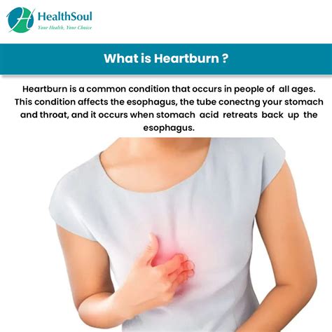 Heartburn: Causes and Treatment – Healthsoul