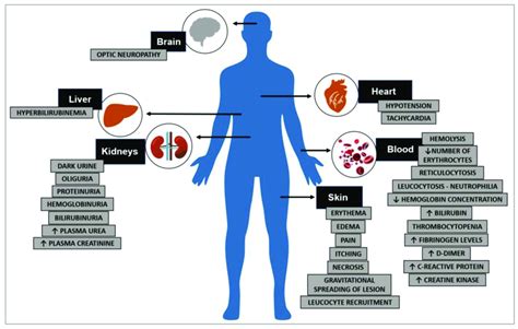 Tissues and organs affected by systemic and cutaneous loxoscelism, and... | Download Scientific ...