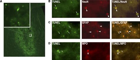 TUNEL (terminal deoxynucleotidyl transferase-mediated 2'-deoxyuridine... | Download Scientific ...