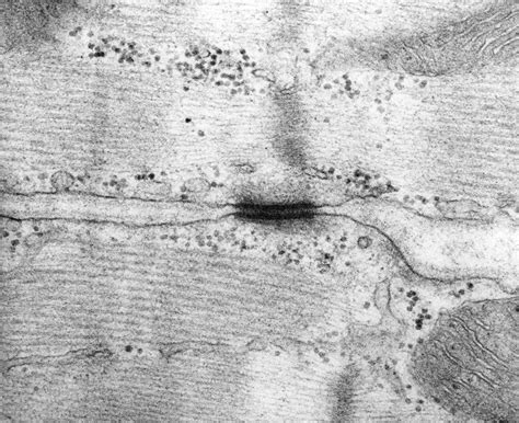 Desmosome between heart muscle cells, TEM - Stock Image - C036/7376 ...