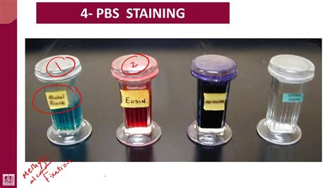 Hematology - 1 | U1-L6 | Blood film staining - YouTube