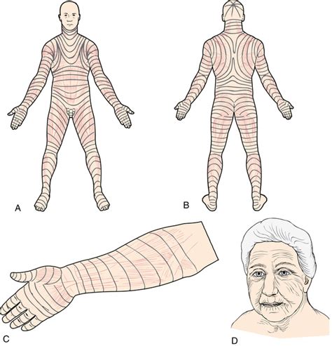 List 104+ Pictures The Term Rachiotomy Is Defined As An Incision Completed