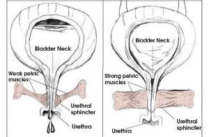 Pelvic Floor Therapy For Men | Review Home Co