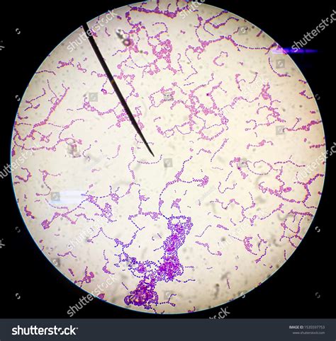 Gram Positive Streptococci