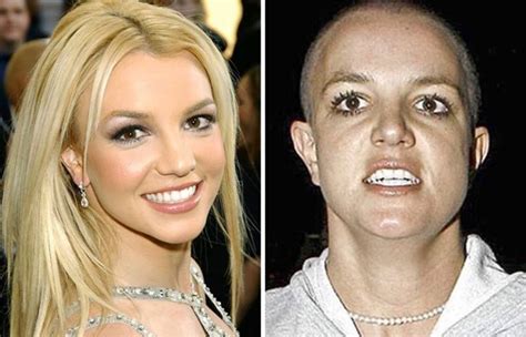 Horrible: 18 Shocking Photos Of Famous Celebrities Before And After ...