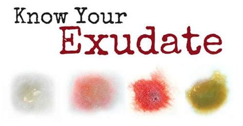 Know Your Exudate | Nursing | Pinterest | The o'jays