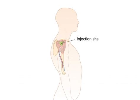 Deltoid Definition Anatomy