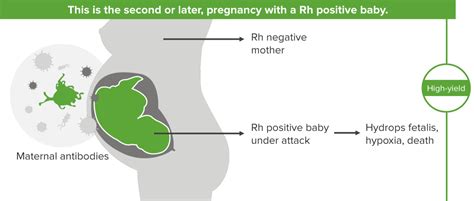 Hemolytic Disease of the Newborn (HDN) — Causes and Symptoms