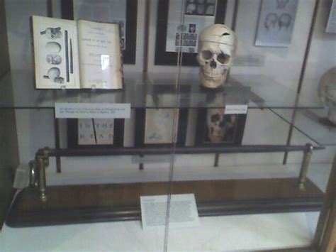 The skull of Phineas Gage, along with the tamping iron which did the ...