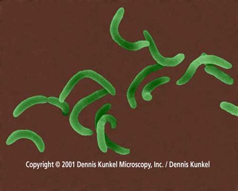 BIOL 230 Lecture Guide - Electron Micrograph of Vibrio cholerae