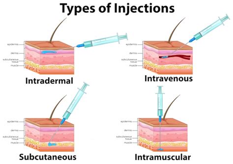 Diagramme Des Types D'injections | Vecteur Gratuite