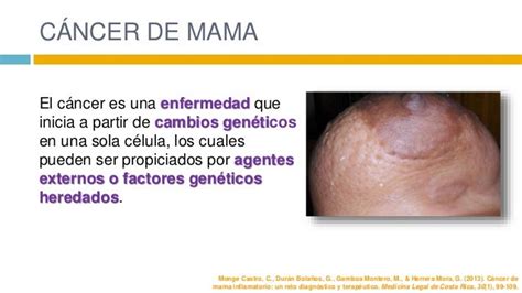 Imagenes De Inicio De Cancer De Mama - CancerWalls