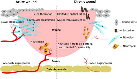 Frontiers | Targeting Tunable Physical Properties of Materials for Chronic Wound Care