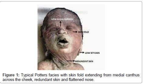 archive-anatomy-physiology-Typical-Potters