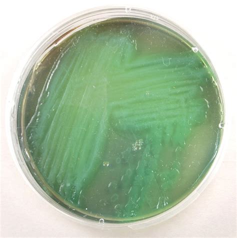 Pseudomonas Aeruginosa Colonies