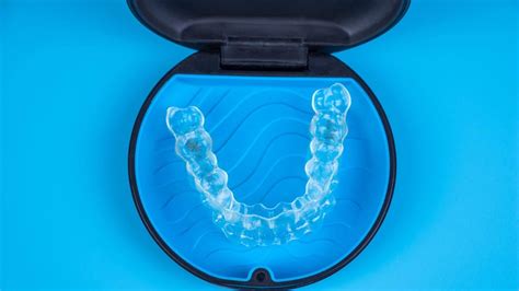 What Are Invisalign Braces? Beauty in Clear Alignment