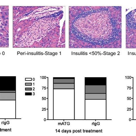 Treatment of NOD mice with mATG attenuates insulitis over time and ...