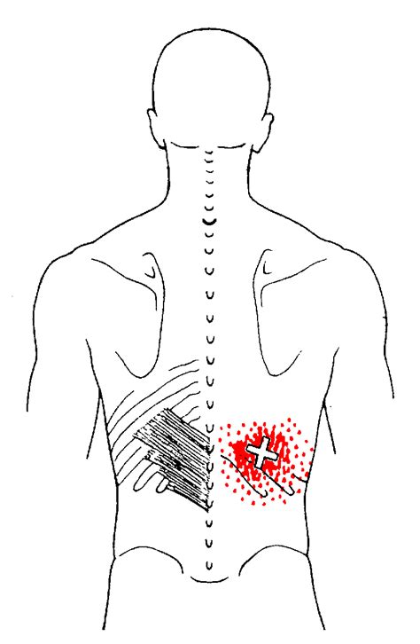 Serratus Posterior Inferior | The Trigger Point & Referred Pain Guide