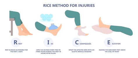 Soft Tissue Injuries: What are They? Types & Treatment | Meril Life