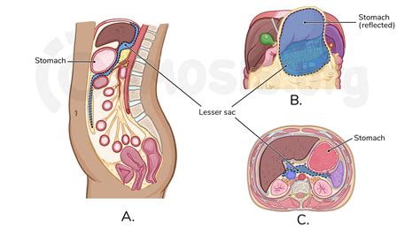 Anatomy of the peritoneum and peritoneal cavity | Osmosis