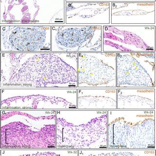 Representative histology of the serosa and the fat tissue around the ...