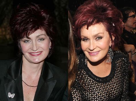 Sharon Osbourne from Better or Worse: Celebs Who Have Had Plastic Surgery | E! News